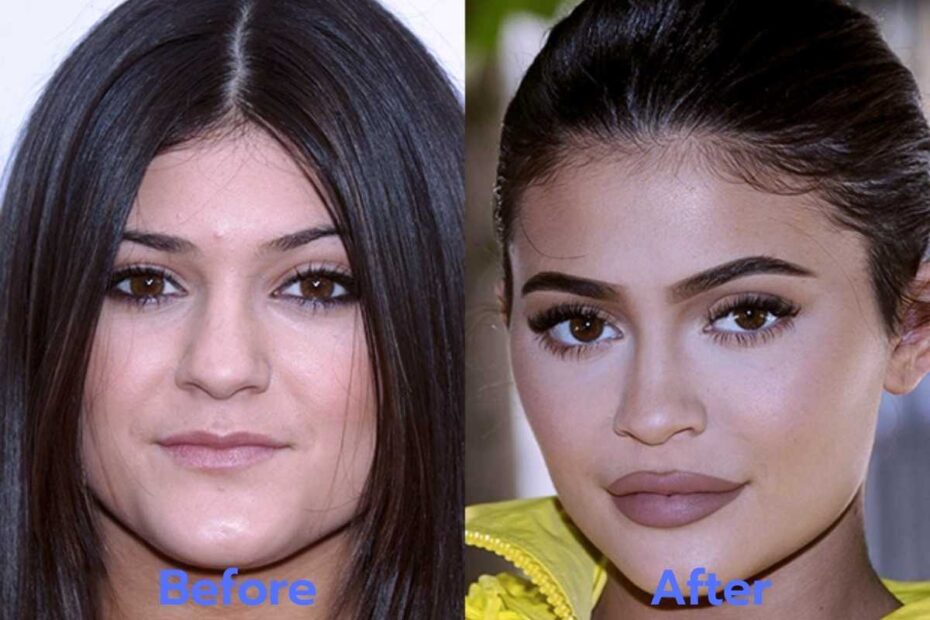 kylie-jenner-eyelid-difference-after-plastic-surgery | Skinny Ninja Mom