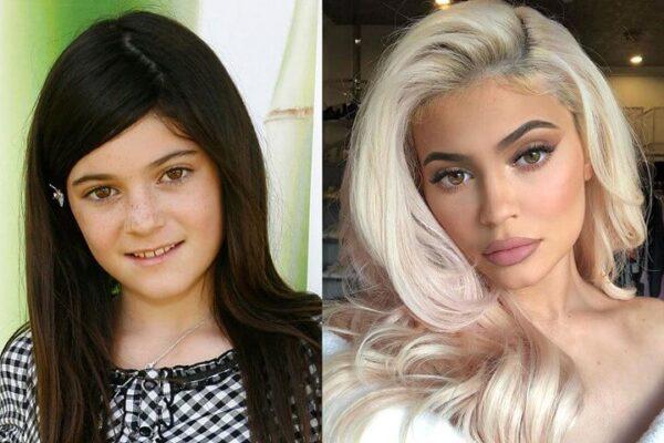 Kylie Jenner Before Surgery