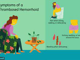 How To Heal Hemorrhoids Bleeding 