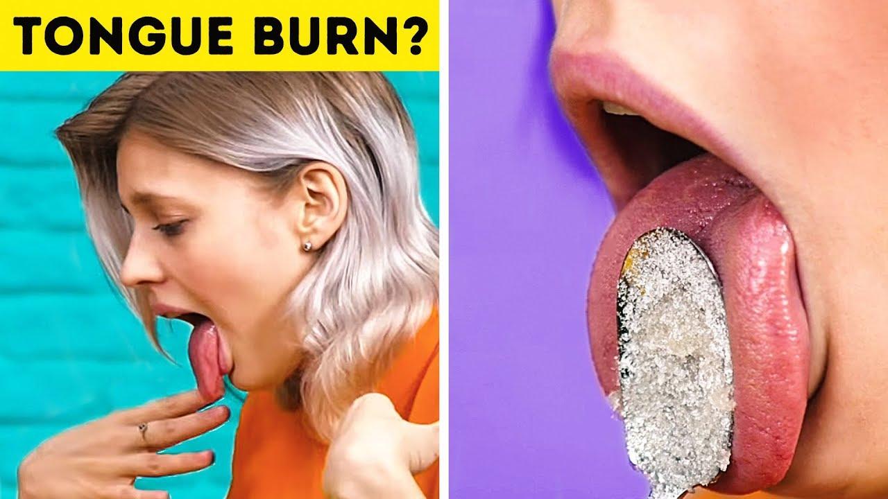 Burnt Tongue Hack