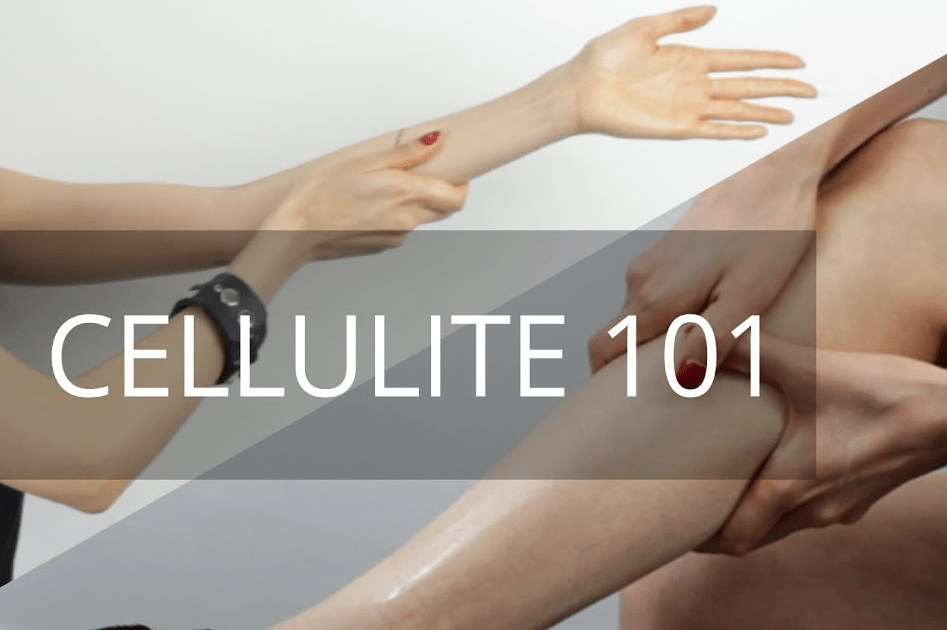 Pryalesin Cellulite Test